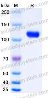 YHD28802, SDS-PAGE