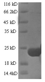 SDS-PAGE