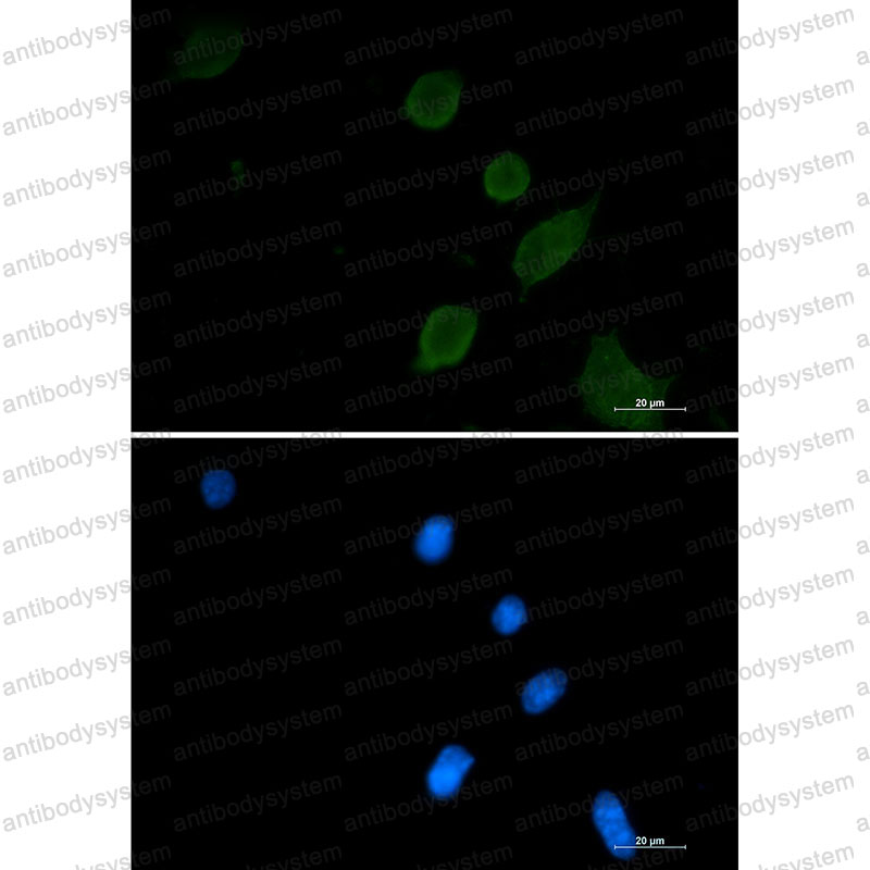 Валидация IF - AntibodySystem RHC32201