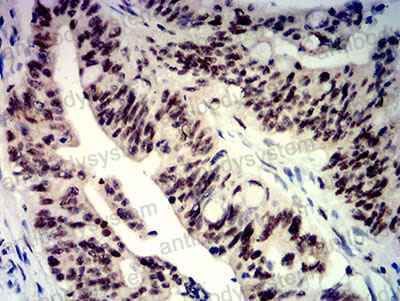 Валидация AntibodySystem RHN96802