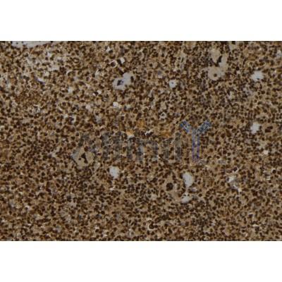 Валидация Affinity DF12077 - 6158