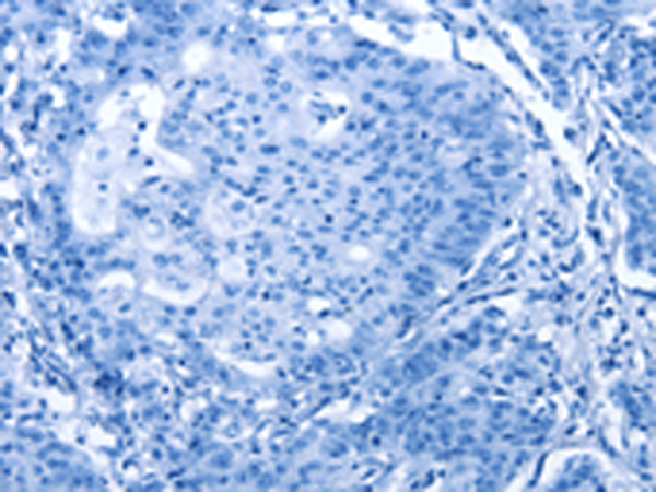 Валидация AssayVector ARM1714(2012)