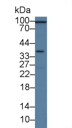 14320