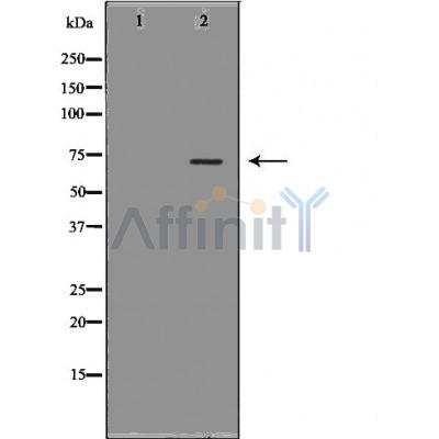 Валидация Affinity AF5318 - 2880
