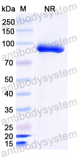 Валидация SDS-PAGE - AntibodySystem RVV09001