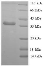 SDS-PAGE