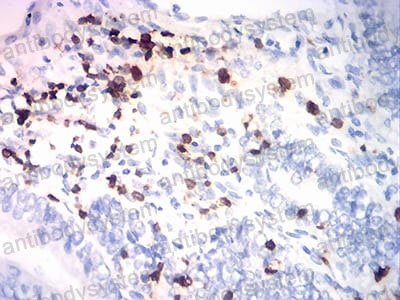 Валидация AntibodySystem RHC41805