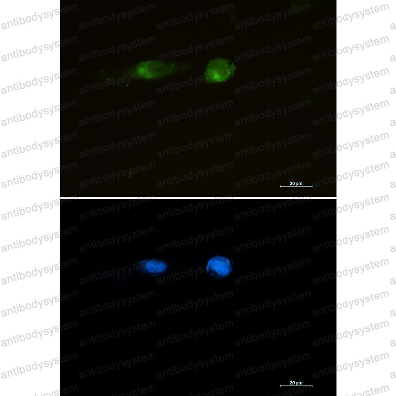 Валидация IF - AntibodySystem RHG14202