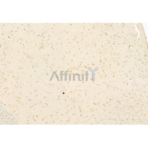 Валидация Affinity DF6009 - 17230