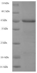 SDS-PAGE