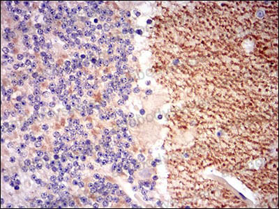 Валидация AntibodySystem RHB34505