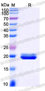 AHA29101, SDS-PAGE