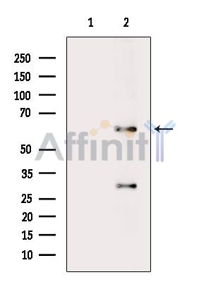 Валидация Affinity AF6828 - 4064