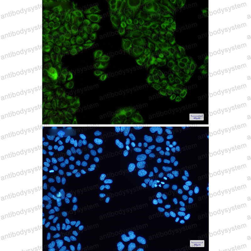 Валидация IF - AntibodySystem RHD18801