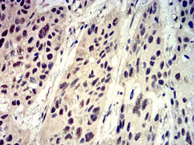 Валидация AntibodySystem RHG57906