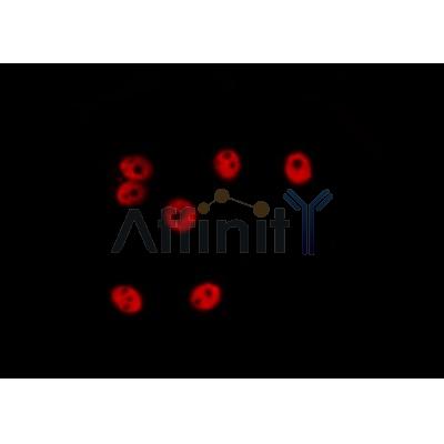 Валидация Affinity DF6372 - 17727