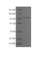 SDS-PAGE