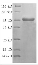SDS-PAGE