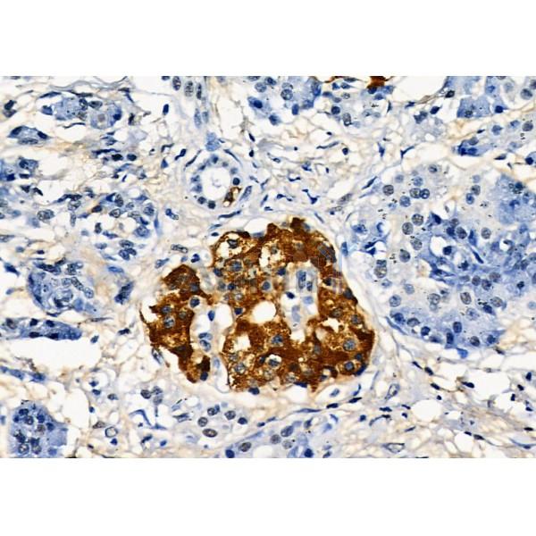 Валидация Affinity DF8228 - 20063