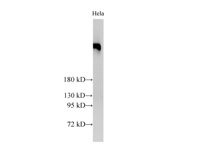 Вестерн-блоттинг, BRCA2, клетки HeLa