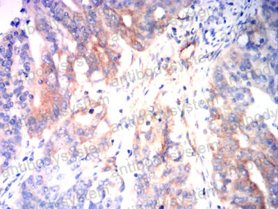 Валидация AntibodySystem RHC36903