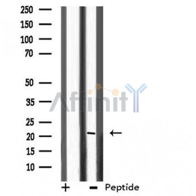 Валидация Affinity DF3864 - 15006