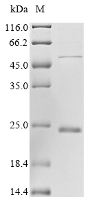 SDS-PAGE