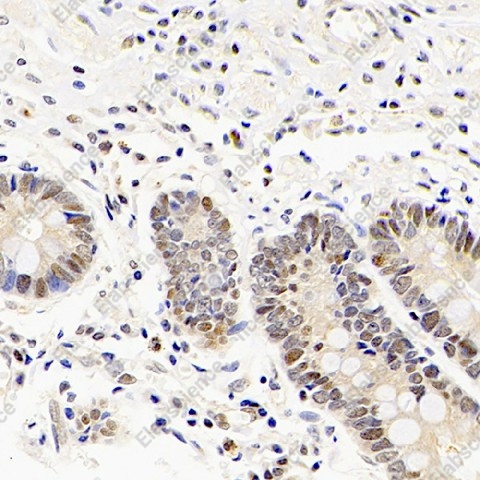Иммуногистохимия, Mineralocorticoid receptor, ткань желудка человека