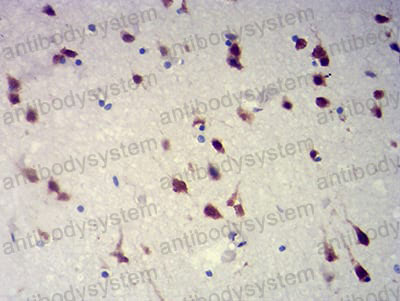 Валидация AntibodySystem RHA61301