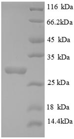 SDS-PAGE