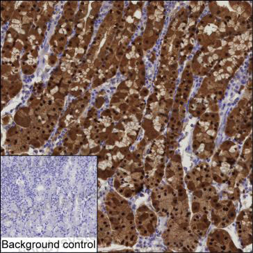 Валидация AntibodySystem RHJ98702