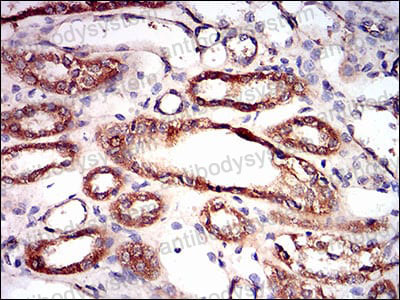 Валидация AntibodySystem RHF03903