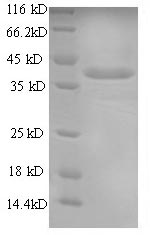 SDS-PAGE