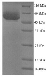 SDS-PAGE