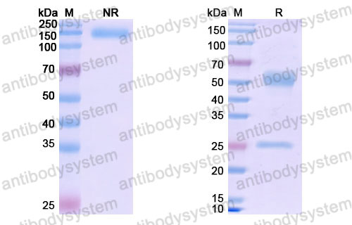 Валидация SDS-PAGE - AntibodySystem DHC09614