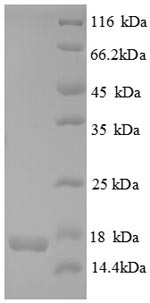 SDS-PAGE