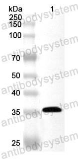 Валидация AntibodySystem PHA75901