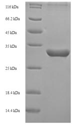 SDS-PAGE