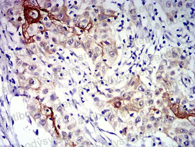 Валидация AntibodySystem RHE67903