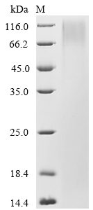 SDS-PAGE
