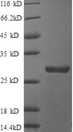 SDS-PAGE