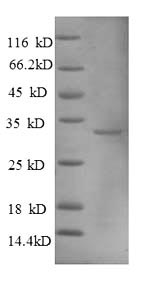 SDS-PAGE