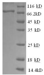 SDS-PAGE
