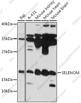 Вестерн-блоттинг, SELENOM, различные клеточные линии