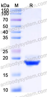 EHH75201, SDS-PAGE