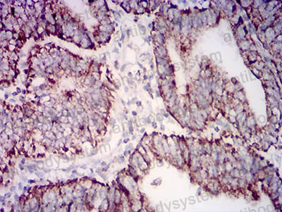 Валидация AntibodySystem RHE60803