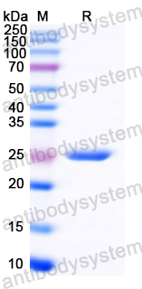 YZZ02701, SDS-PAGE