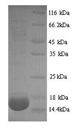 SDS-PAGE