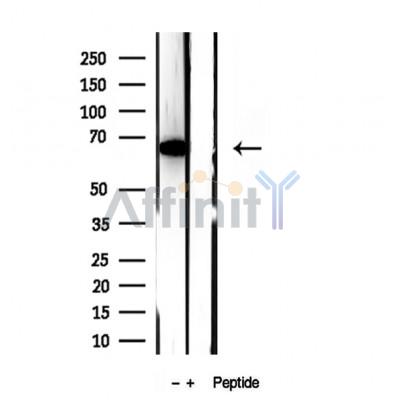 Валидация Affinity DF12020 - 6035