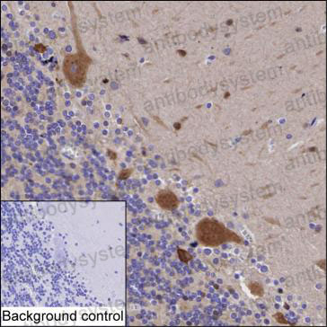 Валидация AntibodySystem RHF65701